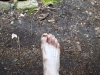 My ugly foot with blister